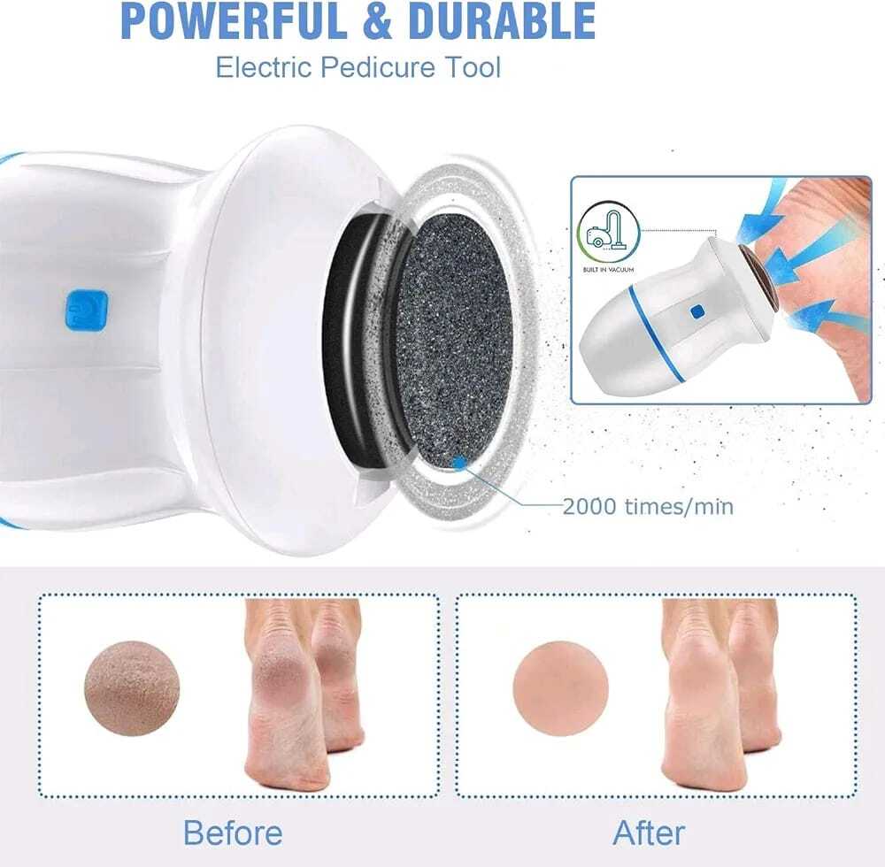 callus-remover-2