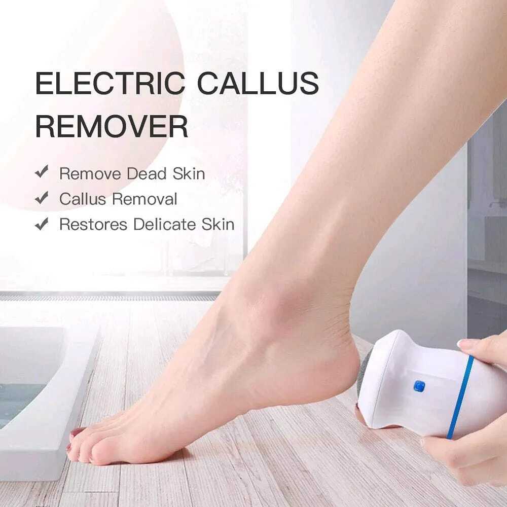 callus-remover-3